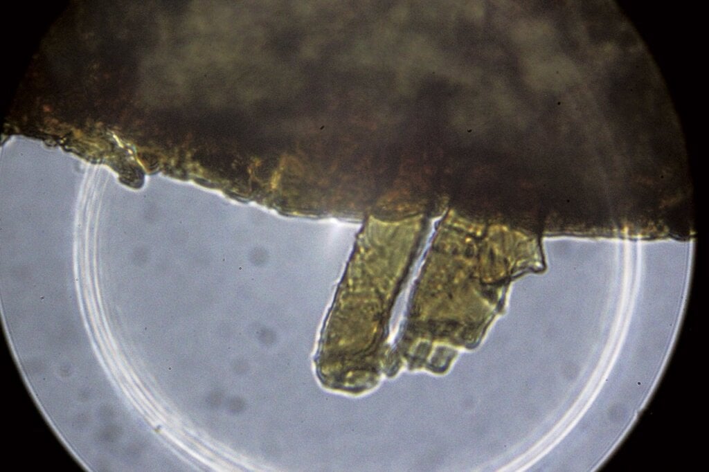 背襯生物顯微照片。