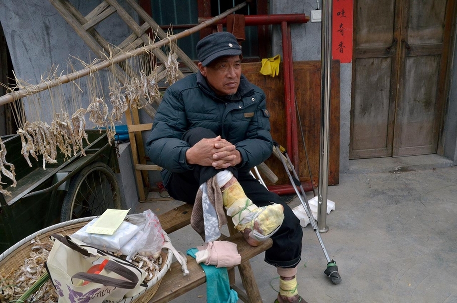 姜春根在兩歲時即染病，攝於2013年大陳鄉。（Courtesy Zukunftsmusik Produktion）