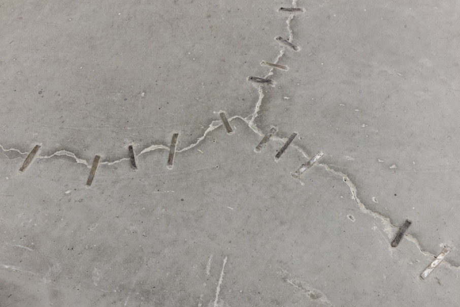卡德爾．阿提亞（Kader Attia），《傳統修復，非物質損傷》（Traditional Repair, Immaterial Injury），2014。（© 上海雙年展）