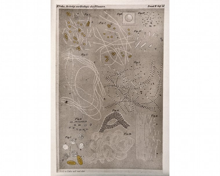 羅伯特．寇赫（Robert Koch）於1876年手繪的炭疽桿菌（Bacillus anthracis）圖像。（© Wellcome Collection）