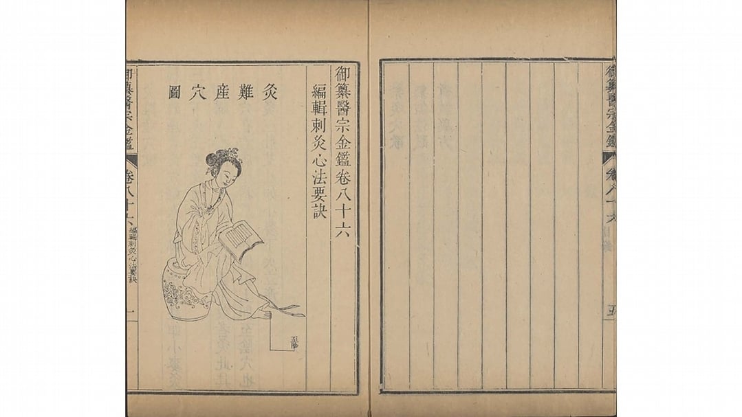 清吳謙、劉裕鐸《御纂醫宗金鑑》之「炙難產穴」，乾隆七年（1742）武英殿刊本，國立故宮博物院藏。（國立故宮博物院提供）
